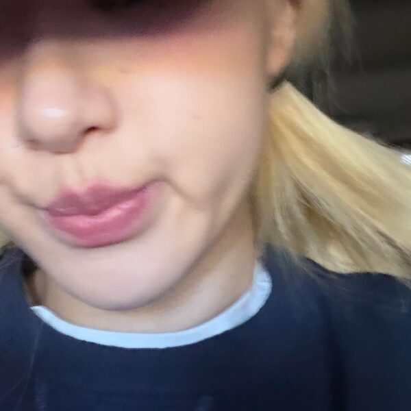 260512 ROSÉ IG Story Update